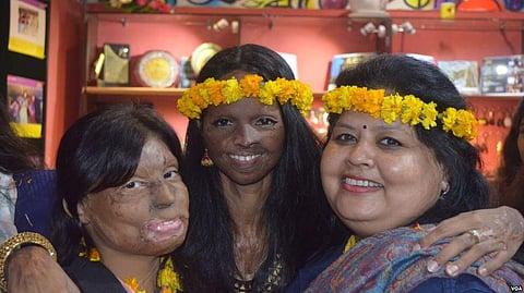 People in India stare at those who don’t fit the norm, says an Acid-attack Victim