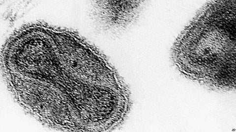 Scientists discover Genetic Evidence of Smallpox from remains of 17th-century Mummy found in Crypt beneath a Lithuanian Church