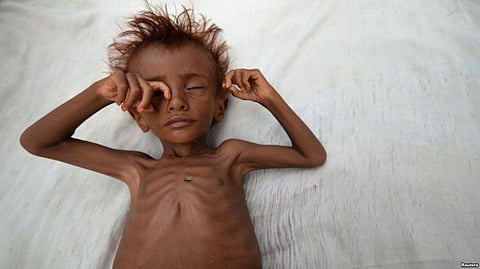 United Nations appeals to pay more attention to Humanitarian Crisis in Yemen