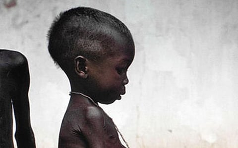 Struck by Malnutrition: ‘Humanitarian Catastrophe’ Looms in Nigeria’s Northeast