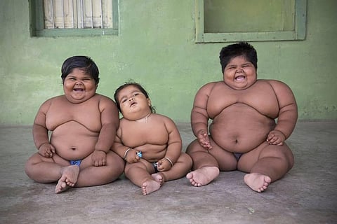 Children at Risk: Obesity is not limited to the Urban Rich of India