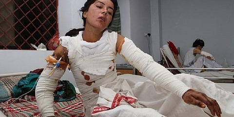 An 18 year-old school teacher set ablaze after refusing a marriage proposal in Pakistan