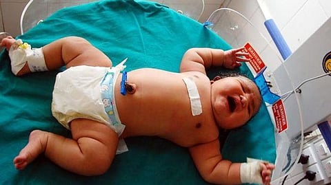 India’s Heaviest Baby weighing 15 Pounds (6.8kgs) is born in Karnataka