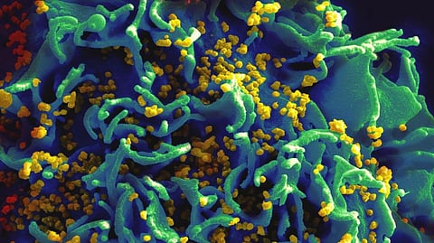 Scientists hopeful of ‘full-length single chain’ AIDS vaccine
