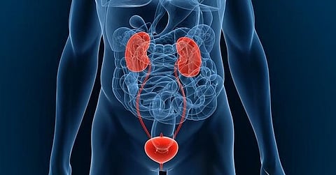 MinION, device to cure urinary tract infection