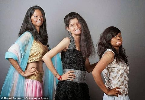 AAP to provide employment to acid attack survivors