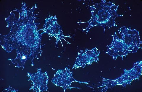 Astrocytes help in keeping the brain healthy, reveals a study