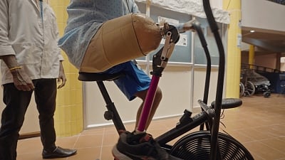 Researchers at the Indian Institute of Technology (IIT) Madras have launched India's first indigenously developed polycentric prosthetic knee, which aims to improve the quality of life for thousands of above-knee amputees. (IANS)