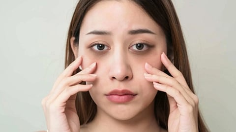 नींद की कमी और थकान से बने डार्क सर्कल्स के लिए 2 मिनट की फेस एक्सरसाइज उपचार।