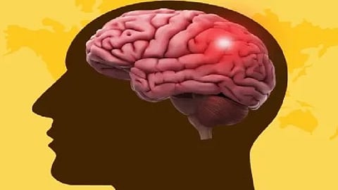 मस्तिष्क की ड्रॉइंग, ब्रेन स्ट्रोक और मानसिक स्वास्थ्य जागरूकता के लिए प्रतीक।