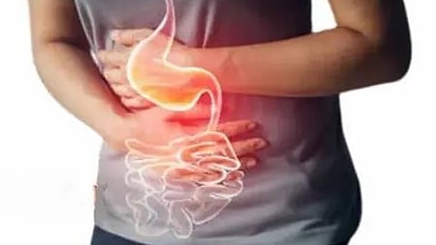 तस्वीर में पेट और आंत का आंतरिक चित्र दिखाई दे रहा है|