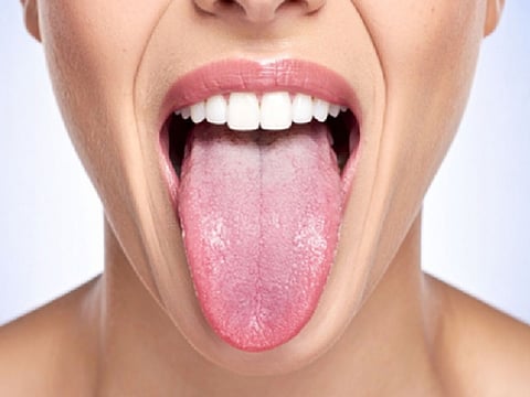 त्रिदोष के असंतुलन का संकेत देती है जीभ, रंग से पहचाने शरीर के विकार