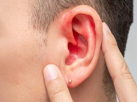 कान की सेहत से आप भी तो नहीं कर रहे खिलवाड़? बड़े काम के हैं ये टिप्स