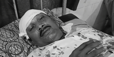 टीएमसी के बदमाशों ने मेरे सिर पर रॉड से वार किया : भाजपा पोलिंग एजेंट