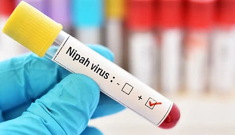 നിപയില് ആശ്വാസം, 42 കാരിയുടെ പരിശോധനാഫലം നെഗറ്റീവ്; വെന്റിലേറ്റര് സഹായമില്ലാതെ ശ്വസിക്കാന് തുടങ്ങി