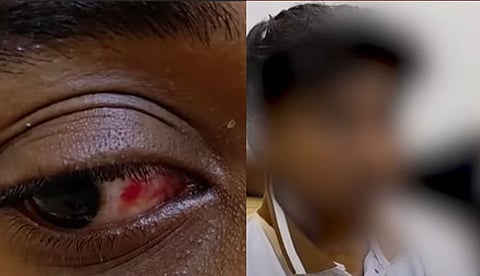 Student attacked by senior students at Kozhikode