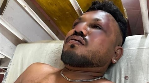 അഹമ്മദാബാദ് വിമാനാപകടത്തില് നിന്ന് രക്ഷപ്പെട്ട വിശ്വാസ് കുമാർ രമേശ്