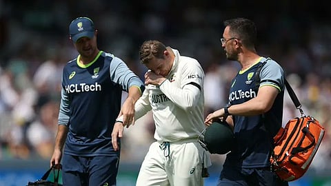 പരിക്കേറ്റ് ഗ്രൗണ്ടില് നിന്ന് മടങ്ങുന്ന സ്റ്റീവ് സ്മിത്ത്