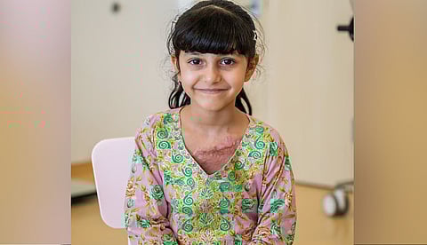 പൊള്ളലേറ്റ മൗസ