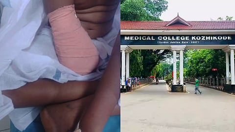 കൈക്ക് വേദനയെന്ന് പറഞ്ഞിട്ടും ശ്രദ്ധിച്ചില്ല; പേശികളിലെ ക്ഷതം മനസിലായില്ല; പാലക്കാട് ജില്ലാ ആശുപത്രിക്ക് ഗുരുതര വീഴ്ചയെന്ന് കോഴിക്കോട് മെഡി. കോളേജ്