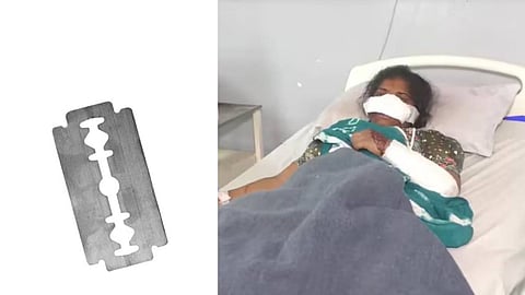 ഭര്ത്താവിന് സംശയ രോഗം; ബ്ലേഡ് കൊണ്ട് ഭാര്യയുടെ മൂക്ക് മുറിച്ചു