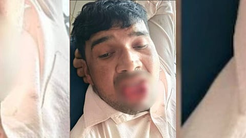 പരിക്കേറ്റ യുവാവ്