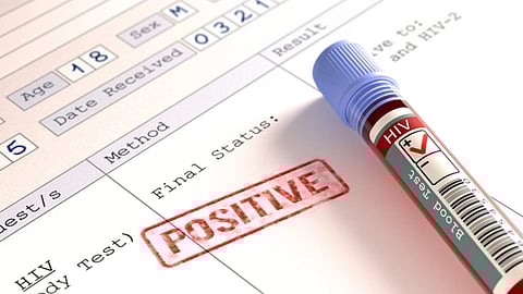 Six children test HIV positive in M.P.’s Satna district hospital blood transfusion case