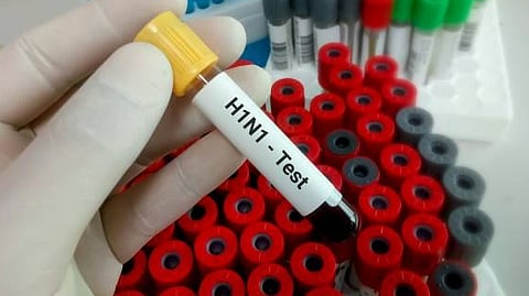 എറണാകുളത്ത് വിദ്യാര്ഥിക്ക് എച്ച് വണ് എന് വണ് സ്ഥിരീകരിച്ചു