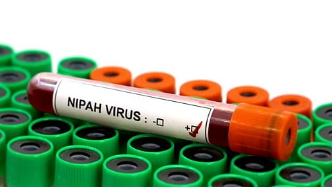 നിപ ബാധ: സംസ്ഥാനത്ത് 675 പേര് സമ്പര്ക്കപ്പട്ടികയില്