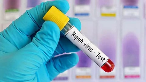 നിപാ വൈറസ്: രണ്ടാം ദിനത്തിലെ പരിശോധനാഫലത്തിലും സംസ്ഥാനത്തിന് ആശ്വാസം