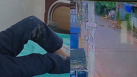 ലോറി തട്ടി മതില് ഇടിഞ്ഞ് കുട്ടികള്ക്ക് മേല് വീണു; അഞ്ചു പേർ ആശുപത്രിയിൽ