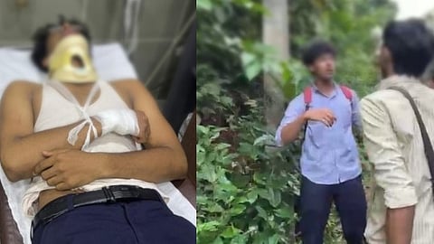 'ഷർട്ടിൻ്റെ ബട്ടൺ ഇട്ടില്ല, പാട്ടും പാടണം'; കണ്ണൂരിൽ സീനിയേഴ്സിൻ്റെ റാഗിങ്ങിൽ പ്ലസ് വൺ വിദ്യാർഥിക്ക് ഗുരുതര പരുക്ക്