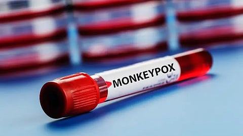 എംപോക്സ്: രാജ്യത്ത് പുതിയ കേസുകളൊന്നും റിപ്പോർട്ട് ചെയ്തിട്ടില്ല, സ്ഥിതിഗതികൾ നിരീക്ഷിക്കുകയാണെന്ന് കേന്ദ്രം