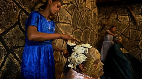 മുഖത്ത് തേൻ, തലയിൽ വെണ്ണ! എത്യോപ്യയിലെ സോന ചികിത്സാരീതിയ്ക്ക് ജനപ്രീതിയേറുന്നു