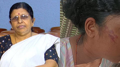 കൊല്ലത്ത് യുവതിയെ ഭർതൃവീട്ടുകാർ ക്രൂരമായി മർദിച്ച സംഭവം; റിപ്പോർട്ട് തേടി വനിത കമ്മീഷന്