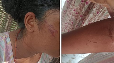 കൊല്ലത്ത് യുവതിയെ ക്രൂരമായി മർദിച്ച സംഭവം; ഭർത്താവിനും ഭർതൃവീട്ടുകാർക്കുമെതിരെ കേസെടുത്തു