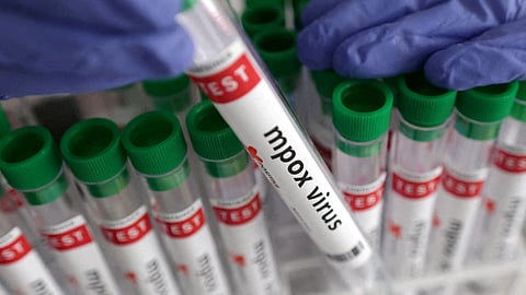 ഇന്ത്യയിൽ എം പോക്സ്; രോഗം സ്ഥിരീകരിച്ചത് ഡൽഹിയിൽ