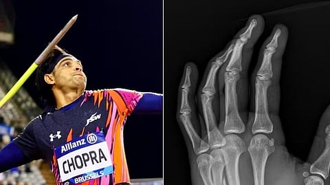 ഡയമണ്ട് ലീഗിൽ വെള്ളി നേടിയത് ഒടിഞ്ഞ കൈയുമായി; ഈ സീസൺ തന്നെ മികച്ചൊരു മനുഷ്യനാക്കിയെന്ന് നീരജ് ചോപ്ര