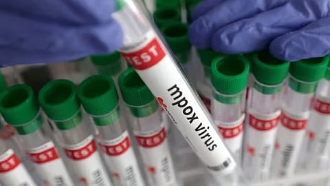 കേരളത്തിലും എംപോക്സ്? ലക്ഷണങ്ങളുമായി മലപ്പുറത്ത് യുവാവ് ചികിത്സയിൽ