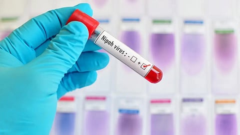 നിപയിൽ ആശ്വാസം; 13 പരിശോധന ഫലങ്ങളും നെഗറ്റീവ്