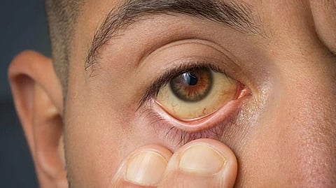 പ്രതീകാത്മക ചിത്രം