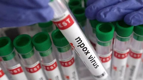 എംപോക്സിൽ ജാഗ്രത ശക്തമാക്കി കേരളം; വിമാനത്താവളങ്ങളിൽ പ്രത്യേക നിരീക്ഷണ സംവിധാനം; രോഗലക്ഷണങ്ങൾ ഉണ്ടെങ്കിൽ റിപ്പോർട്ട് ചെയ്യണം