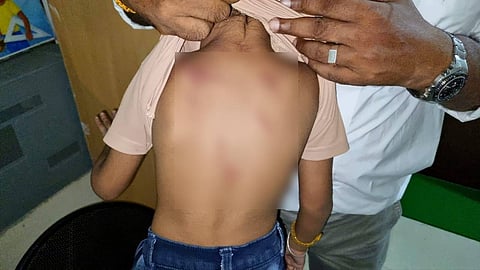 കൊച്ചിയില് മൂന്നര വയസുകാരന് അധ്യാപികയുടെ ക്രൂരമര്ദനം