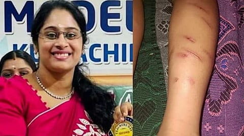 തൃശൂരിൽ അഞ്ച് വയസുകാരനെ മര്ദിച്ച സംഭവം; അധ്യാപിക സെലിനെ നെടുപുഴ പൊലീസ് അറസ്റ്റ് ചെയ്തു