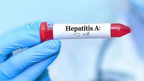 രാജഗിരി കോളേജ് ഓഫ് എഞ്ചിനീയറിംഗിൽ പകർച്ചവ്യാധി; 30 ഓളം പേർക്ക് മഞ്ഞപ്പിത്തം,
ആരോഗ്യ പ്രവർത്തകർ അടിയന്തര യോഗം ചേർന്നു