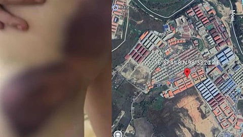 മ്യാൻമറിലെ മനുഷ്യക്കടത്ത്: ഇരകൾ നേരിടുന്നത് ക്രൂര പീഡനം; ഇന്ത്യക്കാരെ താമസിപ്പിച്ചിരിക്കുന്ന പ്രദേശത്തിൻ്റെ ദൃശ്യങ്ങൾ ന്യൂസ് മലയാളത്തിന്