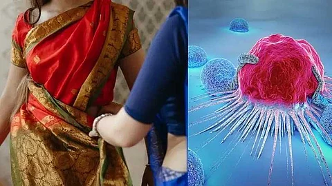 ദിവസവും സാരിയാണോ ധരിക്കാറ്; 'പെറ്റിക്കോട്ട് ക്യാന്സറി'നുള്ള സാധ്യത കൂടുതലെന്ന് റിപ്പോർട്ട്