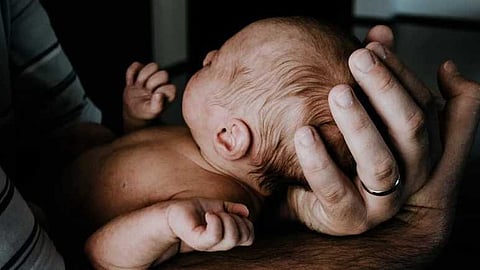 എന്താണ് 'വെയർ വോൾഫ് സിൻഡ്രം'? നവജാത ശിശുക്കളിൽ പടരുന്ന രോഗാവസ്ഥയെക്കുറിച്ച് അറിയാം