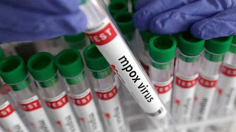 സംസ്ഥാനത്ത് രണ്ടു പേർക്ക് മങ്കി പോക്സ് സ്ഥിരീകരിച്ചു