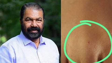 ക്ലാസ് മുറിയിൽ ഏഴാം ക്ലാസുകാരിക്ക് പാമ്പുകടിയേറ്റ സംഭവം; അന്വേഷണത്തിന് ഉത്തരവിട്ട് വിദ്യാഭ്യാസ മന്ത്രി